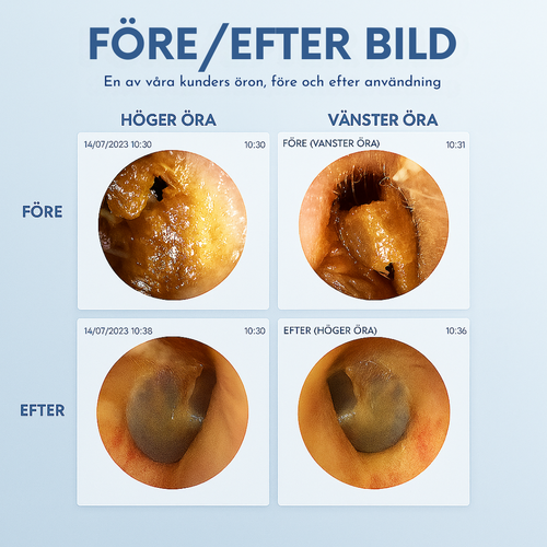 WaxClean™ - Smart öronrengöring med avancerad teknik