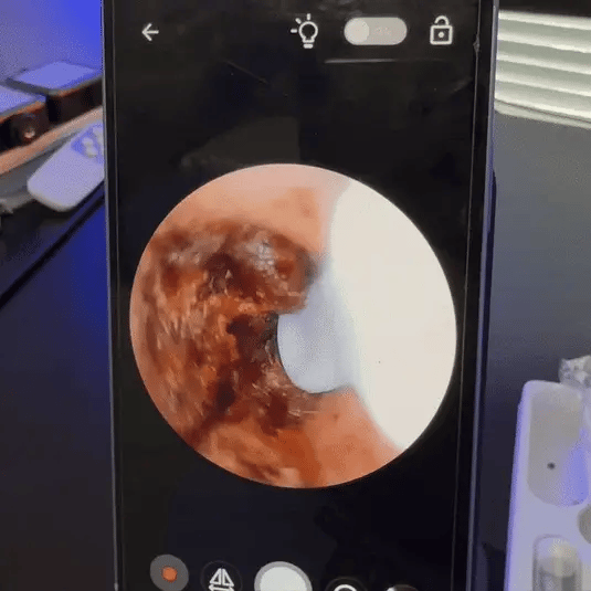 20 Års Öronvaxsamling